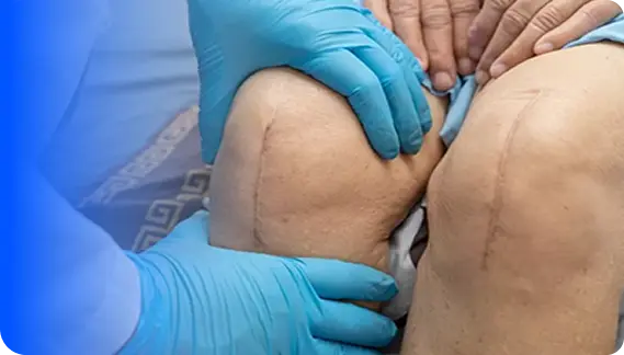 Knee replacement surgery hero