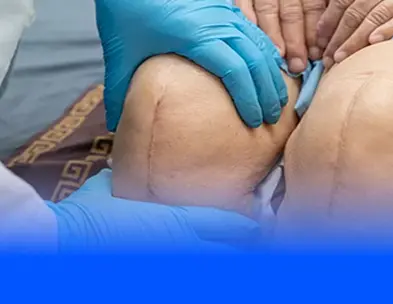 Knee replacement surgery hero